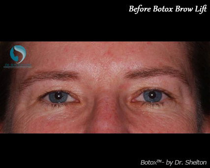 <?php echo $pk; ?> - Before Case 8