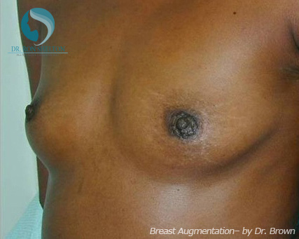 <?php echo $pk; ?> - Before Case 12