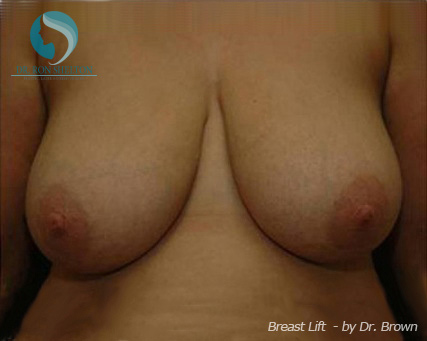 <?php echo $pk; ?> - Before Case 2