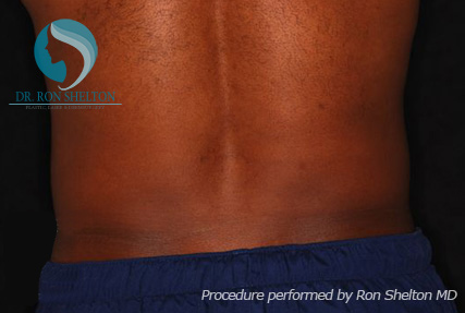 <?php echo $pk; ?> - After Case 1