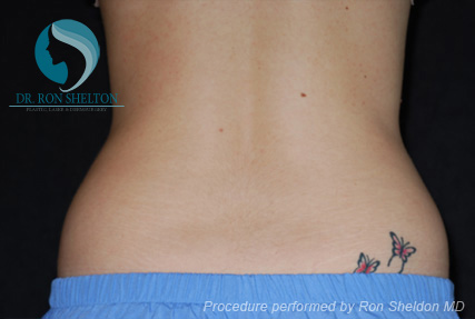 <?php echo $pk; ?> - After Case 5