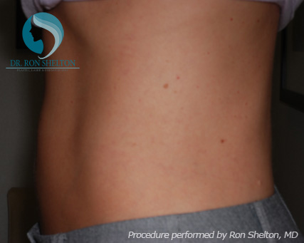 <?php echo $pk; ?> - After Case 6