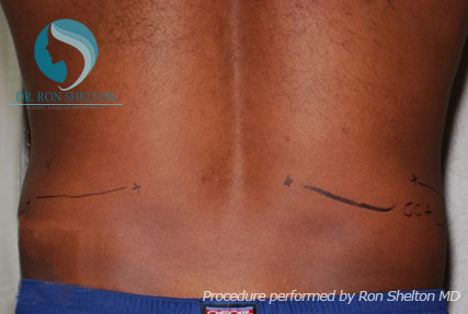 <?php echo $pk; ?> - Before Case 1