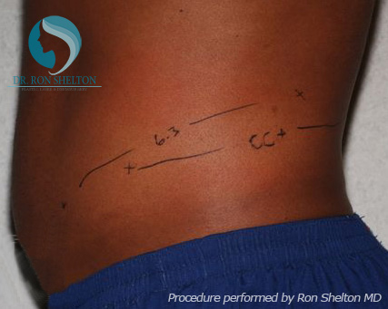 <?php echo $pk; ?> - Before Case 2