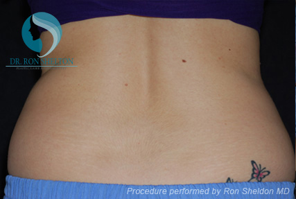 <?php echo $pk; ?> - Before Case 5