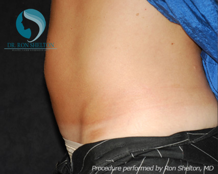 <?php echo $pk; ?> - Before Case 6