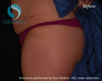 <?php echo $pk; ?> - Before Case 8