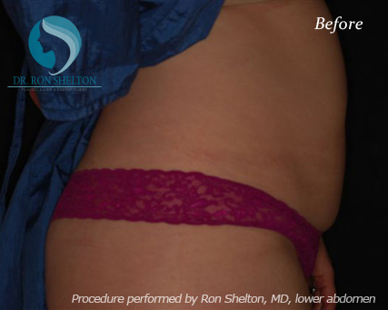 <?php echo $pk; ?> - Before Case 9