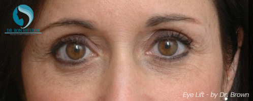 <?php echo $pk; ?> - After Case 3