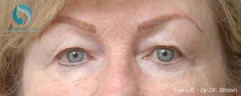 <?php echo $pk; ?> - Before Case 6