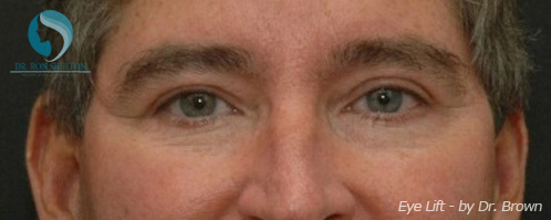 <?php echo $pk; ?> - After Case 7