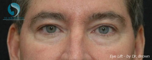 <?php echo $pk; ?> - Before Case 7