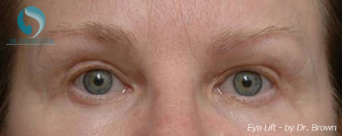 <?php echo $pk; ?> - After Case 7