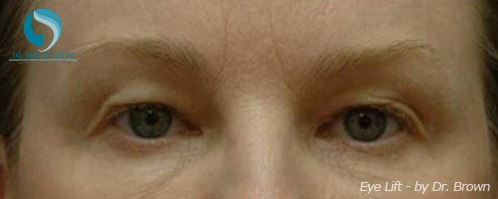 <?php echo $pk; ?> - Before Case 7