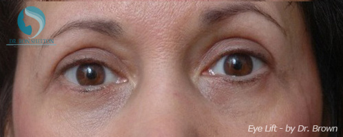 <?php echo $pk; ?> - After Case 2