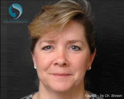 <?php echo $pk; ?> - Before Case 7