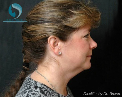 <?php echo $pk; ?> - Before Case 8