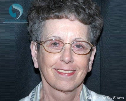 <?php echo $pk; ?> - After Case 16