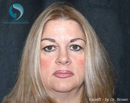 <?php echo $pk; ?> - Before Case 9