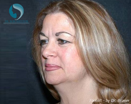 <?php echo $pk; ?> - Before Case 10