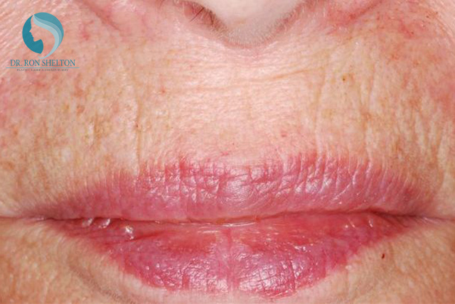 <?php echo $pk; ?> - Before Case 5