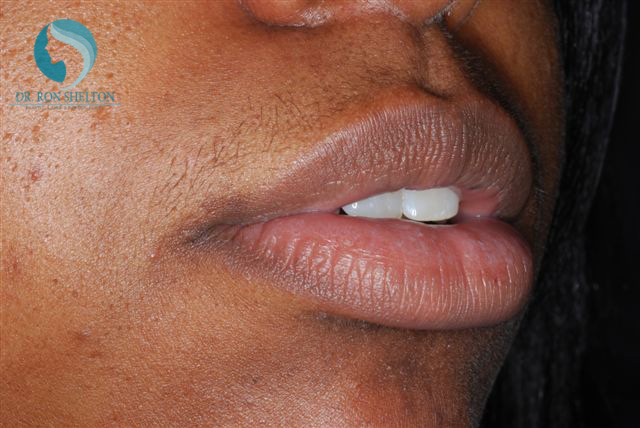 <?php echo $pk; ?> - Before Case 5