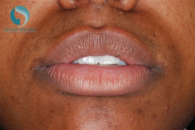 <?php echo $pk; ?> - Before Case 5