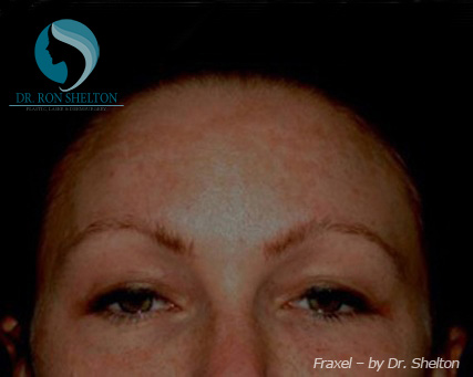 <?php echo $pk; ?> - Before Case 1