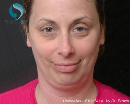 <?php echo $pk; ?> - Before Case 7