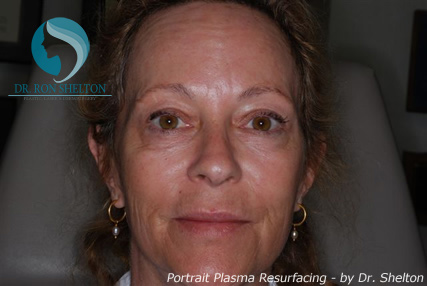 <?php echo $pk; ?> - After Case 2