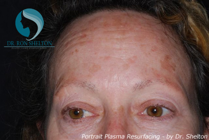 <?php echo $pk; ?> - Before Case 3