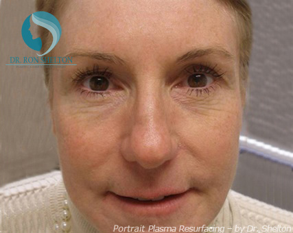 <?php echo $pk; ?> - Before Case 5