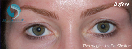 <?php echo $pk; ?> - Before Case 1