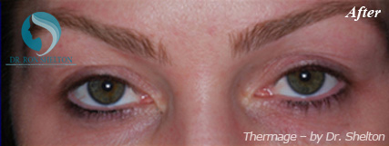 <?php echo $pk; ?> - After Case 1