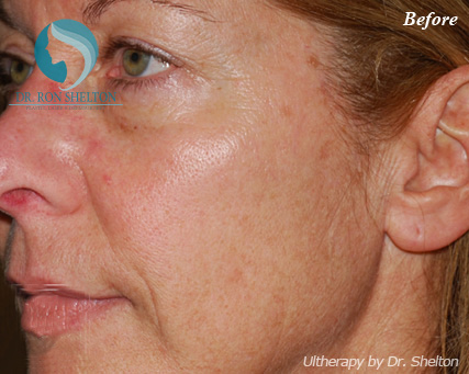 <?php echo $pk; ?> - Before Case 5