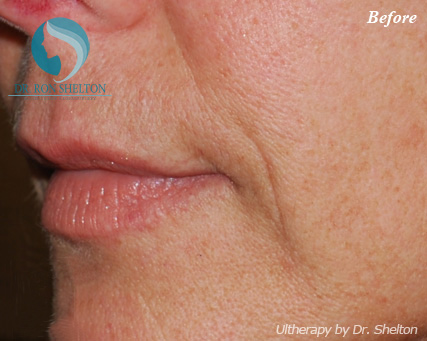 <?php echo $pk; ?> - Before Case 6