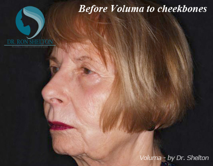 <?php echo $pk; ?> - Before Case 2