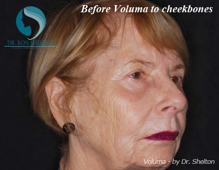 <?php echo $pk; ?> - Before Case 3