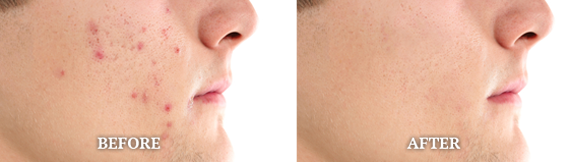 Before After Case 02