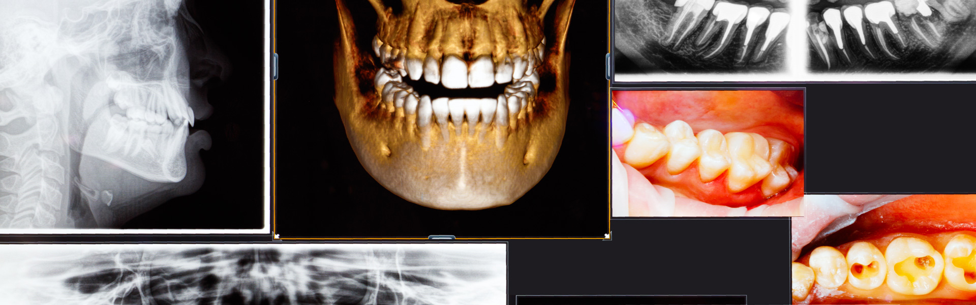 Dental 3d x ray