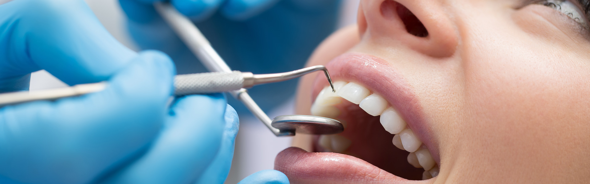 Dentist examining a patient's teeth in the dental