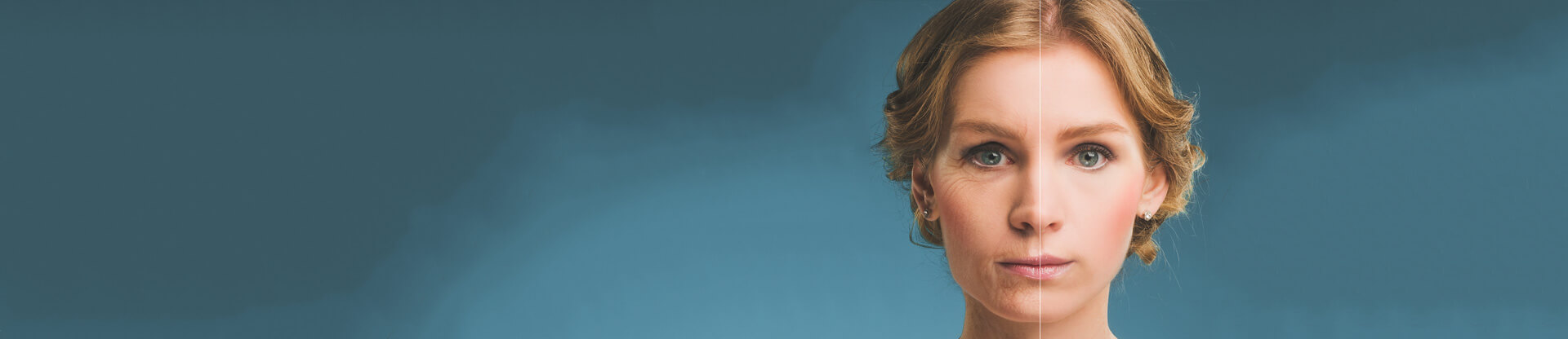 Portrait of a woman before and after botox