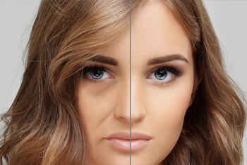 Close-up of female with before after treatment comparison
