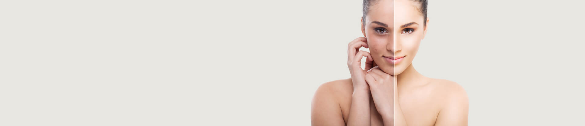 A split photo of a woman before and after retouch