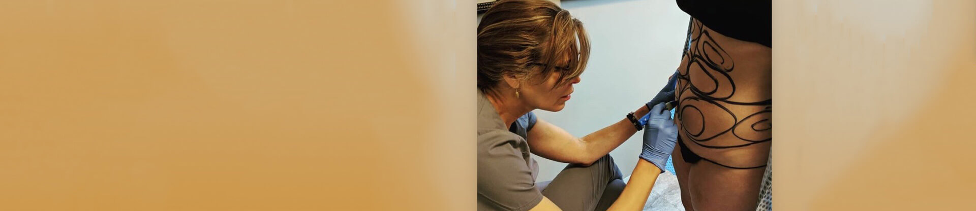 Dr. Susan Schroeder performing liposuction procedure on a patient