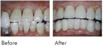 Cosmetic Make Over Before After Case 02