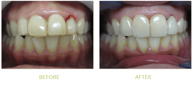 Smile Gallery Before After 12