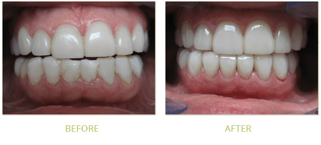 Smile Gallery Before After 08