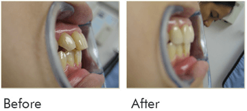 Cosmetic Make Over Before After Case 04
