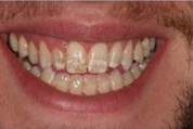 Before Treatment Image 01